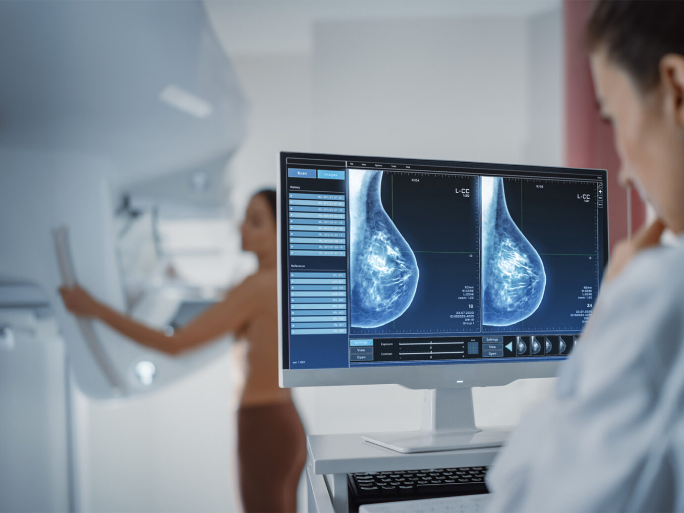 iCAD, GE HealthCare Integrate to Advance Breast Cancer Detection with AI