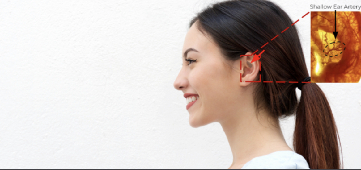 In-Ear Wearable Measures Blood Flow to the Head for Long COVID, POTS
